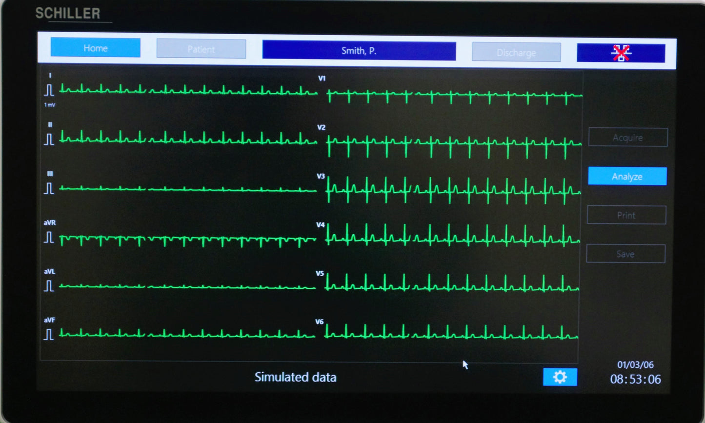 Schiller Diagnostic Station DS-20: All-in-One Vital Signs & EKG with Masimo SpO2