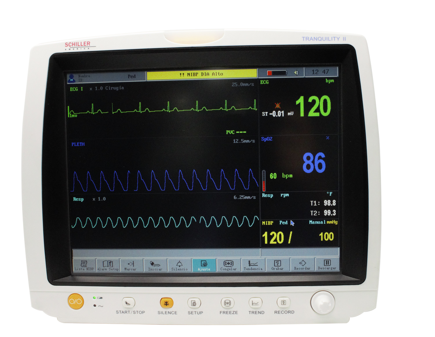 Schiller TRANQUILITY II 12.1" Touchscreen Multiparameter Patient Monitor: Compact, Portable & Versatile