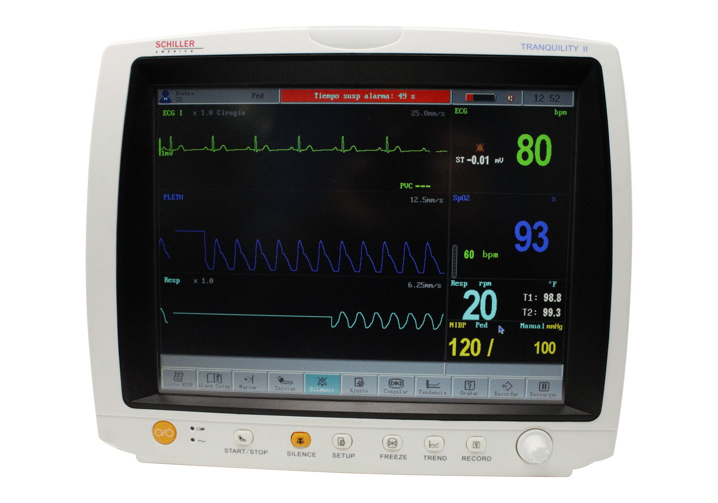Schiller TRANQUILITY II 12.1" Touchscreen Multiparameter Patient Monitor: Compact, Portable & Versatile