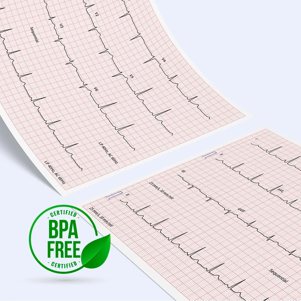 Schiller CARDIOVIT AT-102 G2 EKG with Interpretation: High-Quality, Fast Workflow & Seamless Connectivity