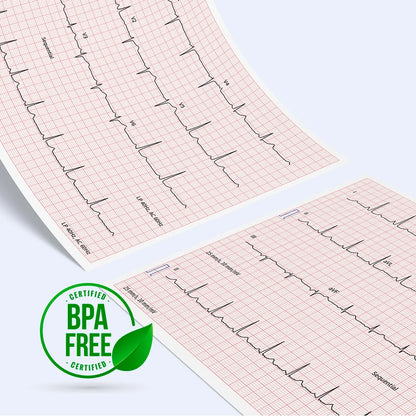 Schiller CARDIOVIT AT-102 G2 EKG with Interpretation: High-Quality, Fast Workflow & Seamless Connectivity