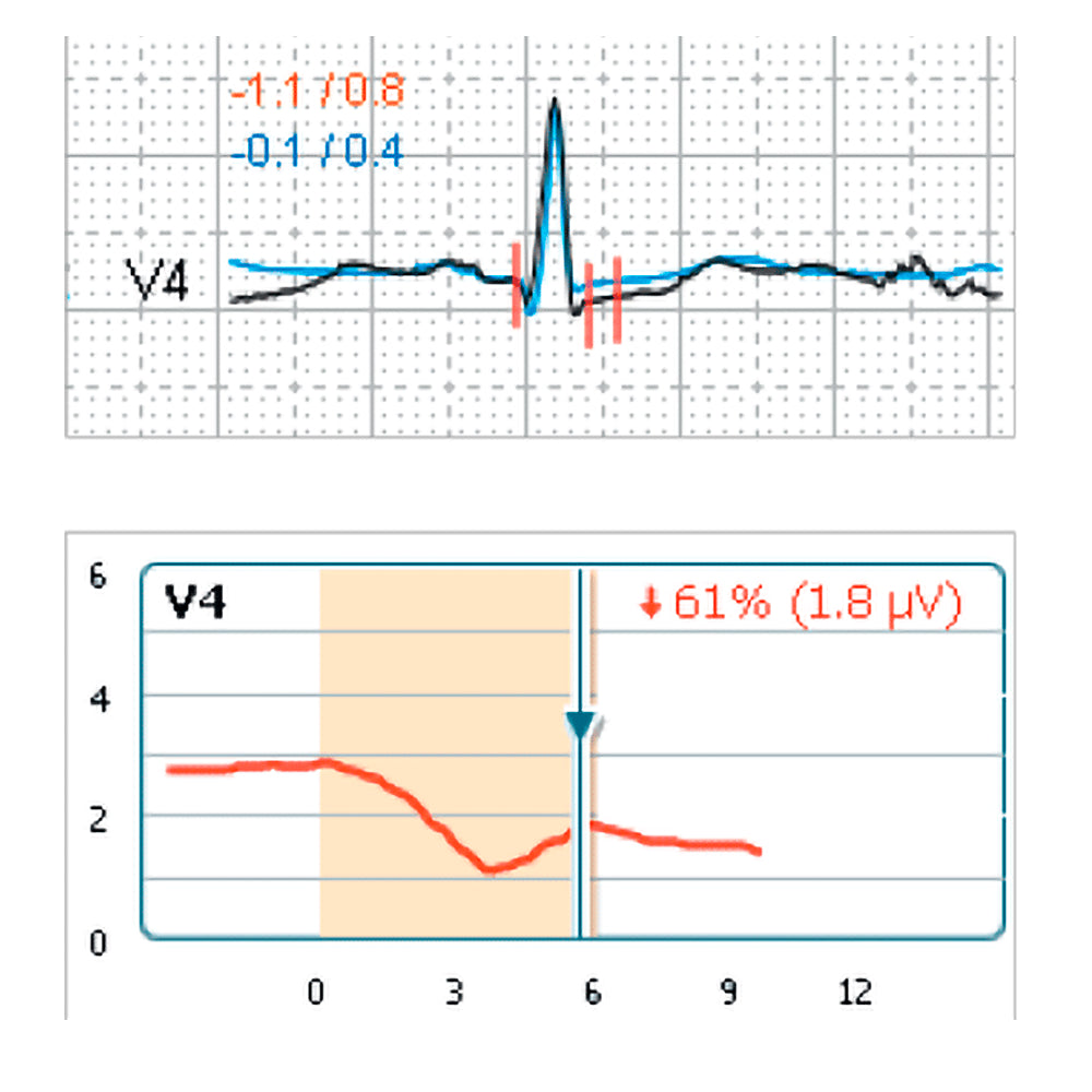 Schiller CARDIOVIT CS-200 Excellence Stress Test System: Advanced Diagnostics, Seamless Connectivity & Performance