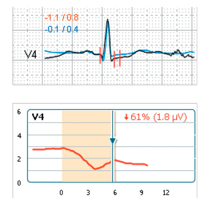 Schiller CARDIOVIT CS-200 Excellence Stress Test System: Advanced Diagnostics, Seamless Connectivity & Performance